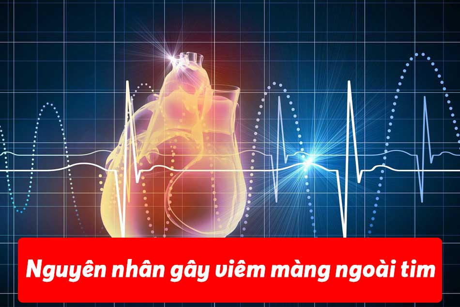 Nguyên nhân gây ra bệnh viêm màng ngoài tim