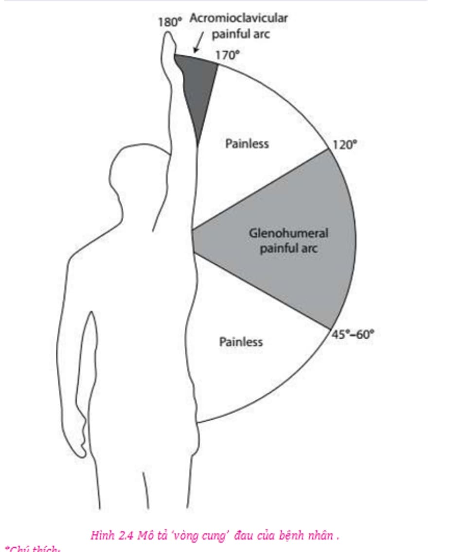 Hình 2.4 Mô tả ‘vòng cung’ đau của bệnh nhân .
