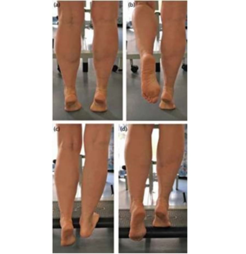 Hình 5.9 (a) Kiễng hai chân, (b) kiễng 1 chân (c) và (d) nâng gót chân với sức tải lớn.