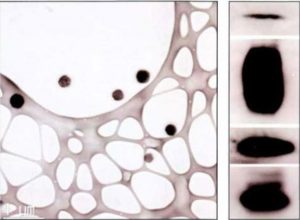 Hình 3-8 Đặc trưng của protein của bóng xuất bào (exosome) Westerblot Nguồn: Stem Cell Research and Therapy 2018;9:87.