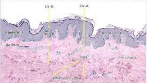 Hình 10-3 Ultraviolet light interacts with different skin cells at different depths Energy from UVB rays is mostly absorbed by the epidermis and affects epidermal cells such as the keratinocytes. Energy from LVA rays affects both epidermal keratinocytes and the deeper dermal fibroblasts, AP-1, activator protein 1; NF-KB, nuclear factor KB, matrix metalloproteinasn mtDNA, mitochơndrial DNA; ROS, reactive oxygen species.