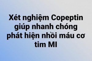 Xét nghiệm Copeptin giúp nhanh chóng phát hiện nhồi máu cơ tim MI