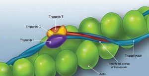 Troponin