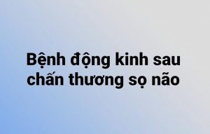 Bệnh động kinh sau chấn thương thường gặp ngay cả sau khi chấn thương sọ não TBI nhẹ