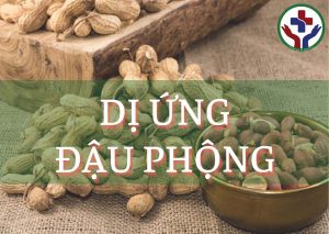 Dị ứng đậu phộng