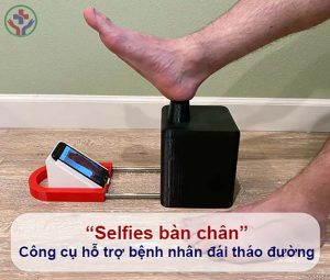 Công cụ hỗ trợ bệnh nhân đái tháo đường chăm sóc loét bàn chân