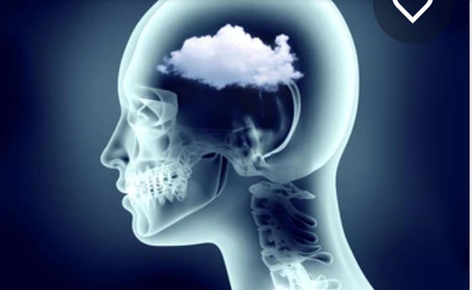 Sương mù não có thể tồn tại 8 tháng sau nhiễm COVID-19.