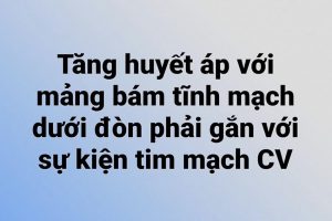 Tăng huyết áp với mảng bám tĩnh mạch dưới đòn phải gắn với sự kiện tim mạch CV