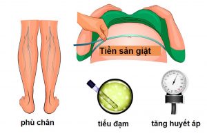 Tiền sản giật, sản giật tăng nguy cơ suy tim trong ít nhất 10 năm.