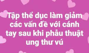 Tập thể dục làm giảm các vấn đề với cánh tay sau khi phẫu thuật ung thư vú.