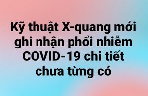 Kỹ thuật X-quang mới ghi nhận phổi nhiễm COVID-19 chi tiết chưa từng có