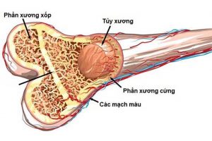 Tiêm ngoài màng cứng thắt lưng Steroid Jab làm giảm sự hình thành xương ở phụ nữ lớn tuổi.