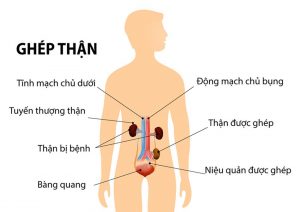 Ca ghép thận gần đây đang diễn ra với tốc độ kỷ lục