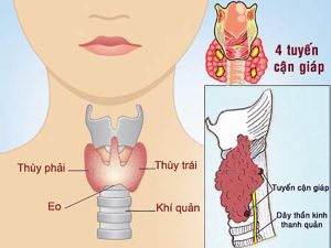 Sử dụng TransCon PTH trong điều trị suy cận giáp trên người trưởng thành ghi nhận có nhiều lợi ích