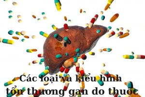 Các loại và kiểu hình tổn thương gan do thuốc